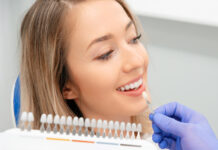 Dental Veneers in Fort Lauderdale: Your Complete Guide to Perfecting Your Smile