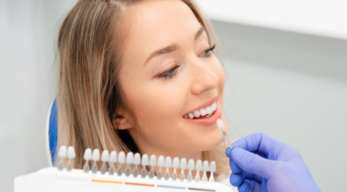 Dental Veneers in Fort Lauderdale: Your Complete Guide to Perfecting Your Smile