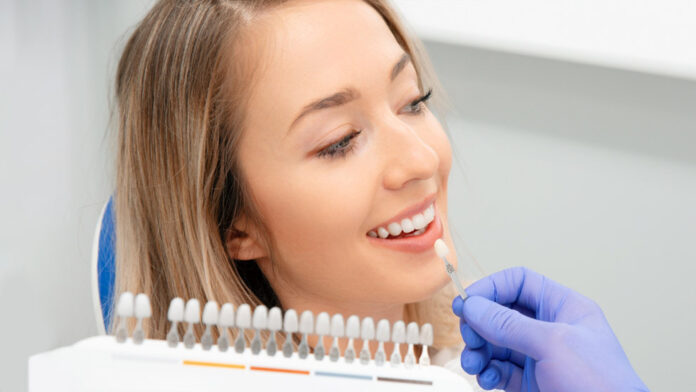 Dental Veneers in Fort Lauderdale_ Your Complete Guide to Perfecting Your Smile